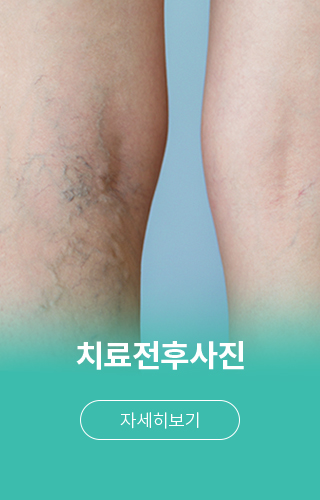 치료전후사진