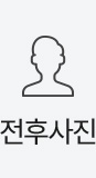 전후사진