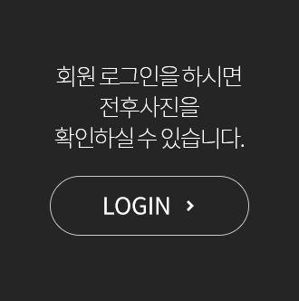 회원 로그인을 하시면 전후사진을 확인하실 수 있습니다. 