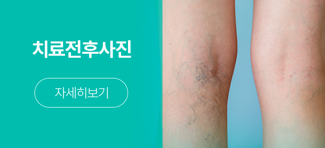 치료전후사진